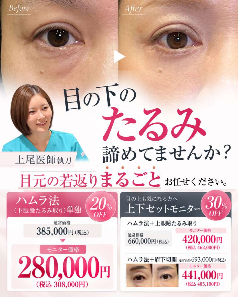 「目元の若返り」モニター募集