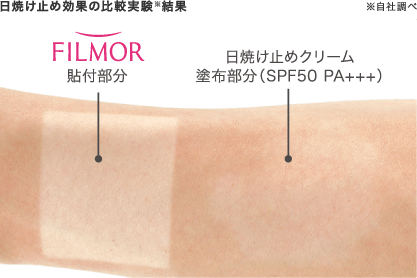 シミ治療を躊躇している方へ