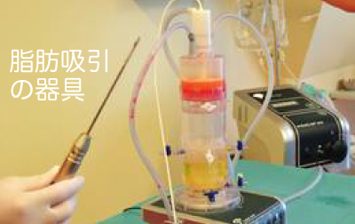 脂肪吸引の器具（写真）