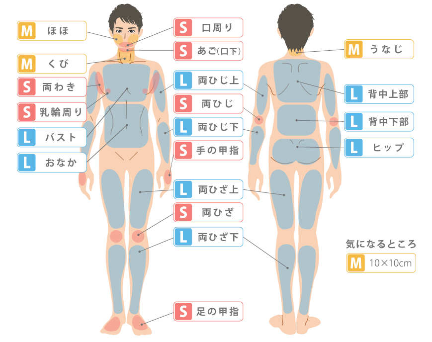 医療レーザー 脱毛 エステ 永久脱毛 レーザー脱毛 ダイオード ソプラノ ジェントル SMLパーツ　部分脱毛　男性脱毛範囲