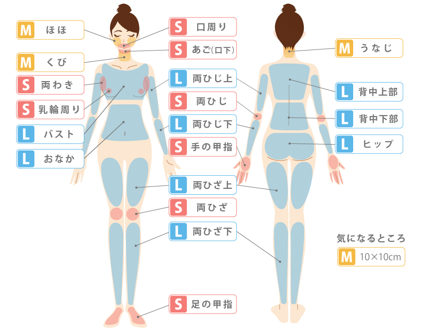 医療レーザー 脱毛 エステ 永久脱毛 レーザー脱毛 ダイオード ソプラノ ジェントル SMLパーツ　部分脱毛　女性脱毛範囲