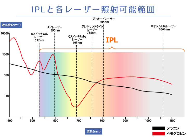 光エネルギー（IPL）と各レーザーの照射可能範囲を示したグラフ