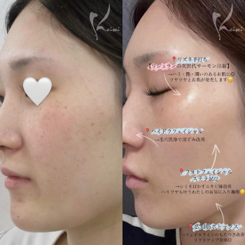 わたしの人生を変えた美容施術たちサムネイル