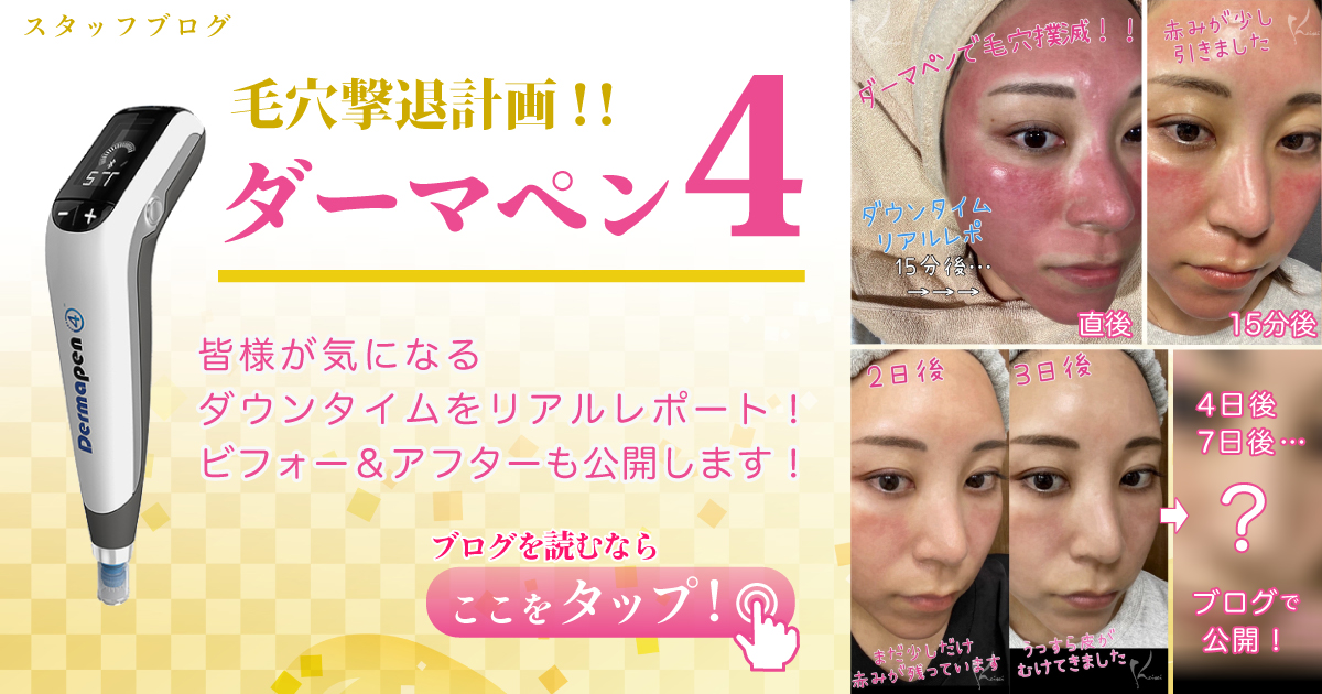 ダーマペン4で、毛穴撃退計画！！｜恵聖会クリニック｜大阪の美容外科