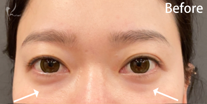 スタッフBefore写真