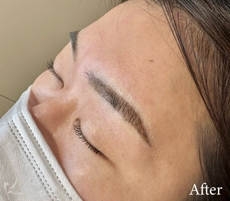 眉アートメイクAfter写真