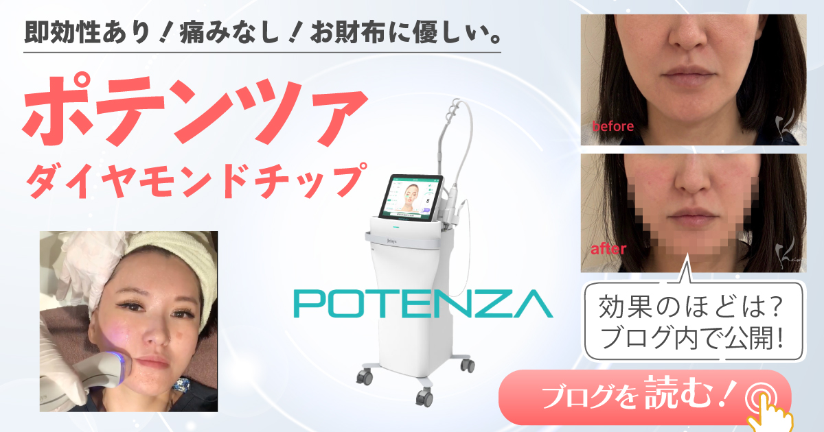 フェイスラインのもたつきにポテンツァ ダイアモンドチップ｜恵聖会