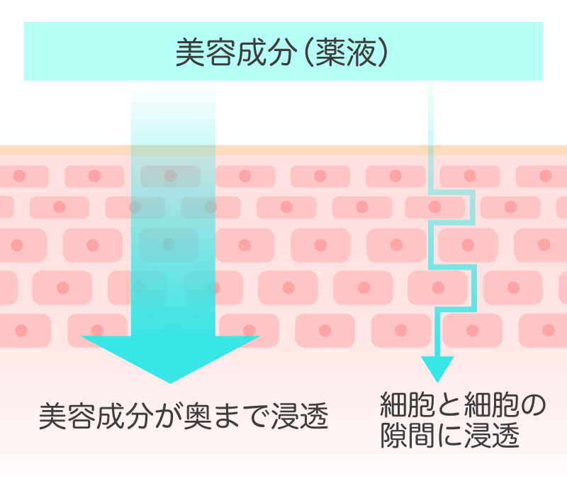 ケアシスの原理