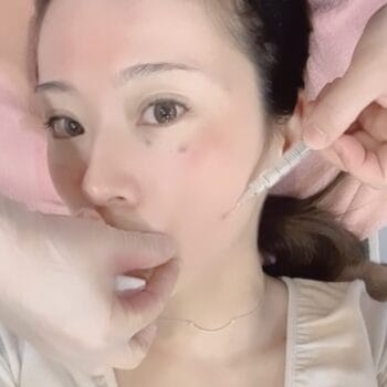 ブナジュ（BNAJU）の施術を受ける看護師のイメージ