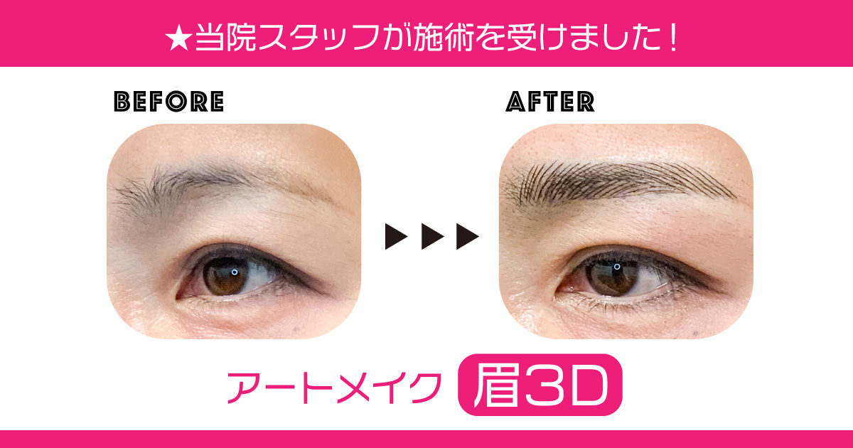 人気の3dアートメイクです 恵聖会クリニック 大阪の美容外科 美容皮膚科