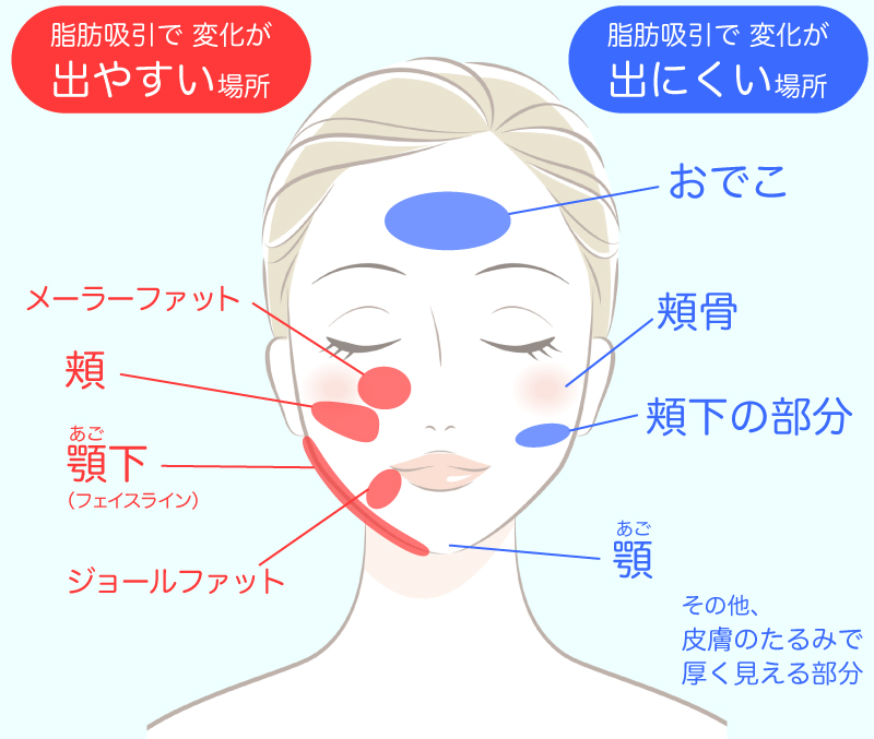 得意な場所・苦手な場所の顔イラスト