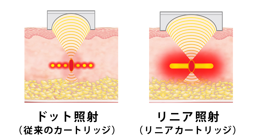 従来のカートリッジの照射とリニアファームの照射の違い